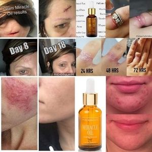 Miracle oil 1fl.oz/ 30ml